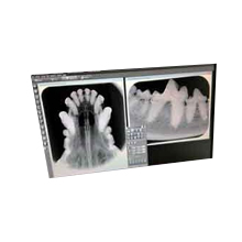 Dental X-Ray (CR & DR) ||